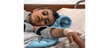 علاج مرضى الفشل الكلوي باليمن - جمعية النجاة الخيرية